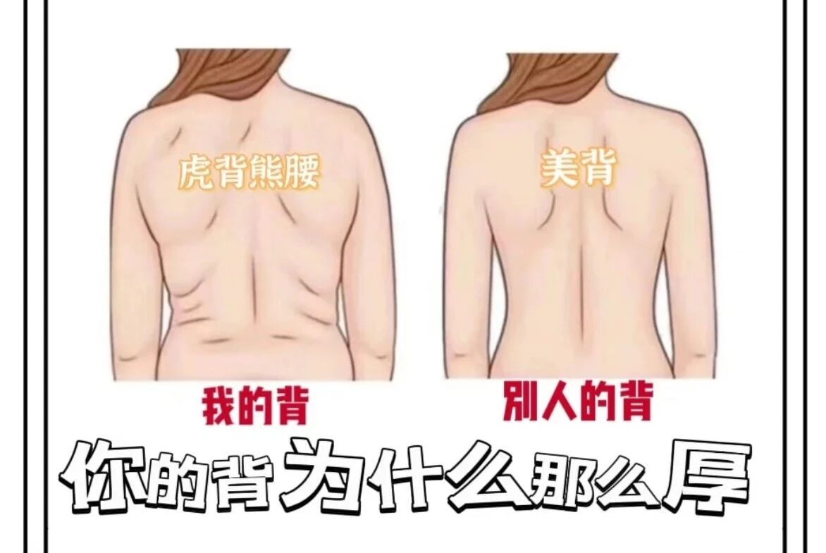 体态矫正