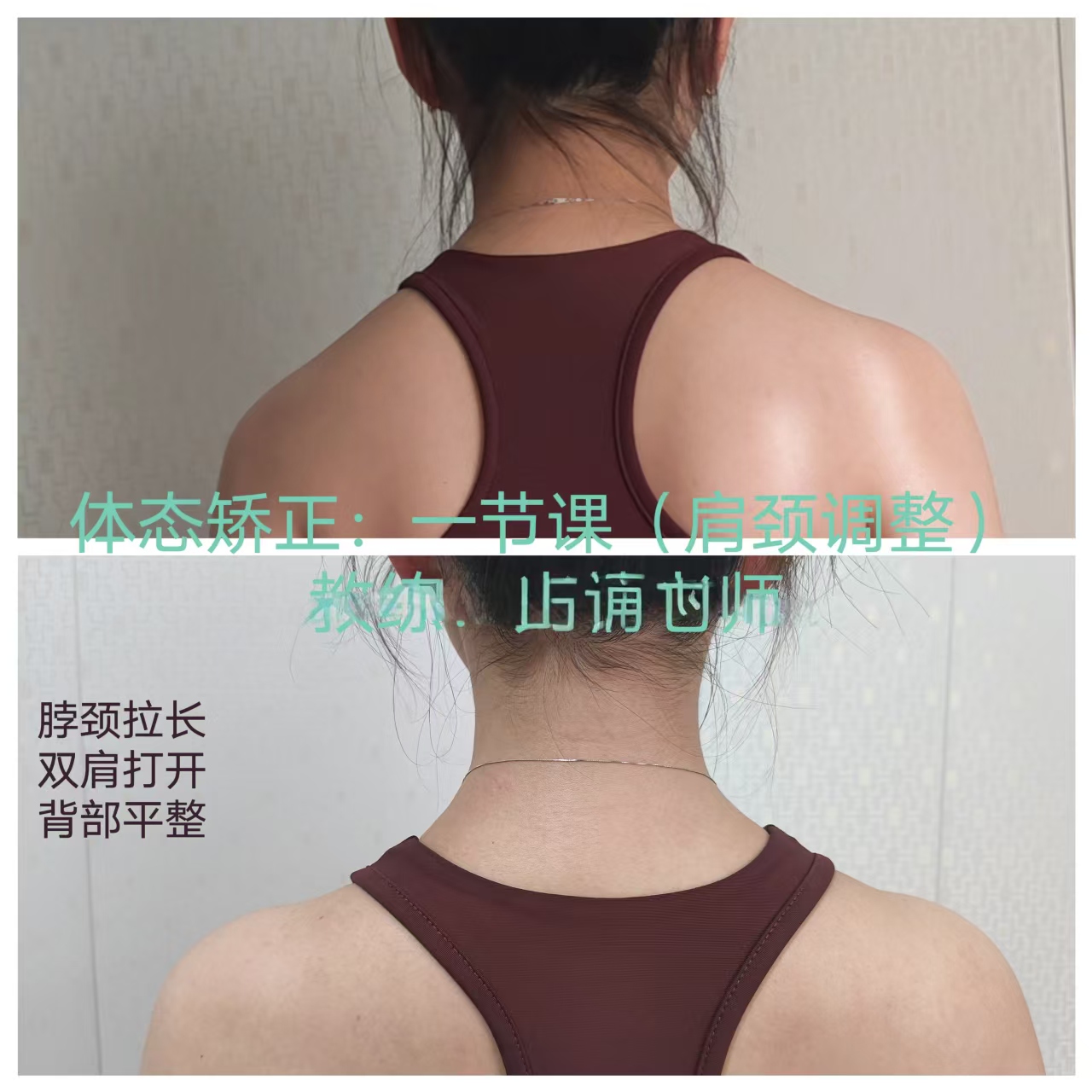 体态矫正